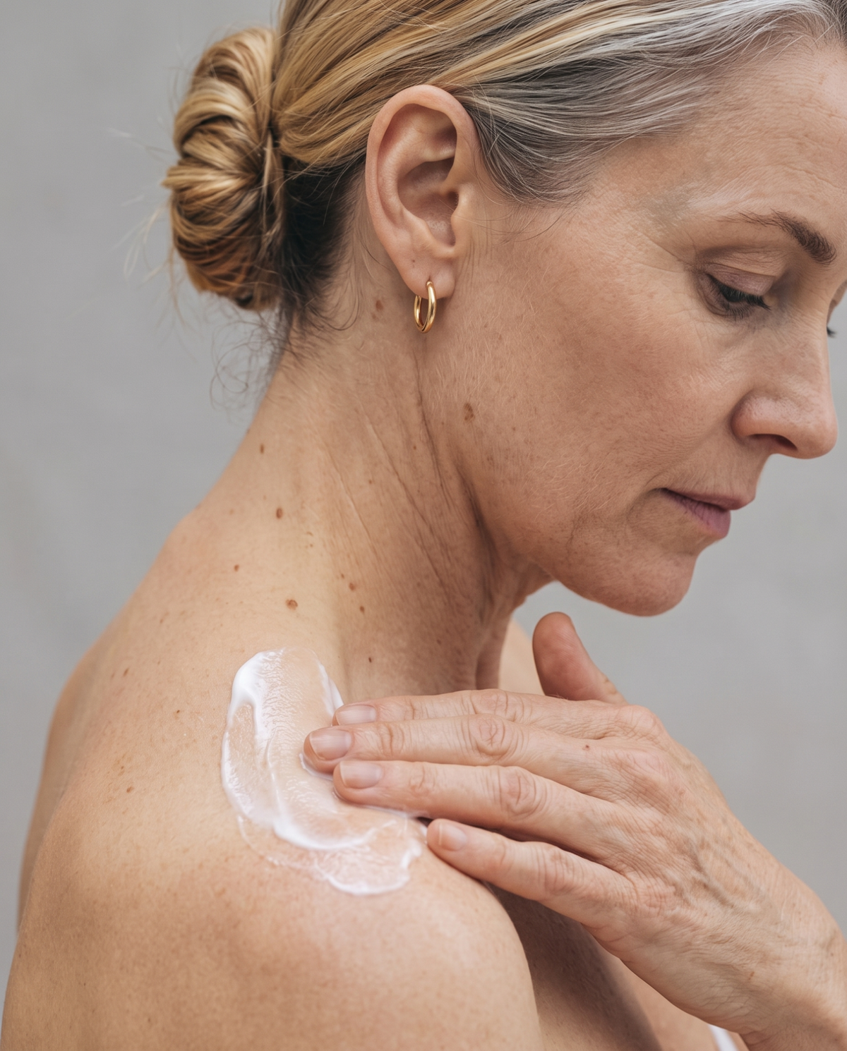 Dry skin